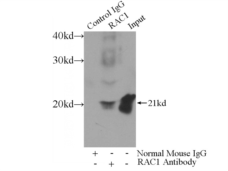 IP Result of anti-RAC1 (IP:Catalog No:107494, 3ug; Detection:Catalog No:107494 1:700) with HL-60 cells lysate 4000ug.