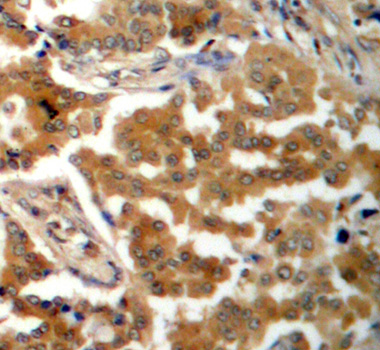 Immunohistochemistry - Phospho-ADD1-S726 pAb 