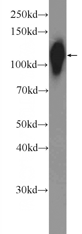 mouse small intestine tissue were subjected to SDS PAGE followed by western blot with Catalog No:108774(CDH17 Antibody) at dilution of 1:2000