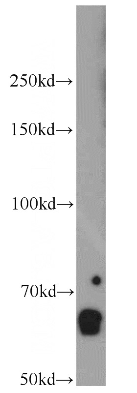 mouse kidney tissue were subjected to SDS PAGE followed by western blot with Catalog No:110571(FAM13A antibody) at dilution of 1:500