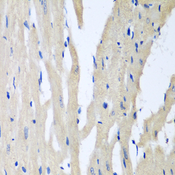 Immunohistochemistry - PITRM1 Polyclonal Antibody 