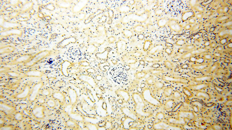 Immunohistochemical of paraffin-embedded human kidney using Catalog No:111750(IL9 antibody) at dilution of 1:50 (under 10x lens)