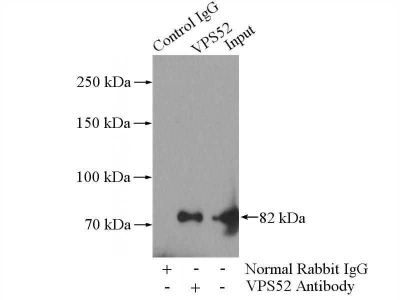 IP Result of anti-VPS52 (IP:Catalog No:116793, 3ug; Detection:Catalog No:116793 1:1000) with mouse skin tissue lysate 3200ug.