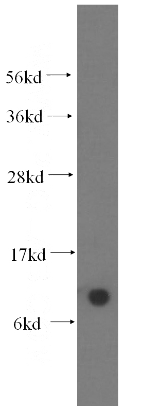 human liver tissue were subjected to SDS PAGE followed by western blot with Catalog No:109494(COX6B1 antibody) at dilution of 1:400