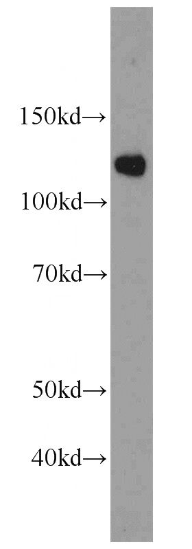 HeLa cells were subjected to SDS PAGE followed by western blot with Catalog No:114972(SART1 antibody) at dilution of 1:1000