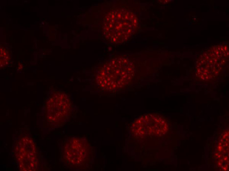 Immunofluorescence - Phospho-MAPKAPK2-T334 pAb 
