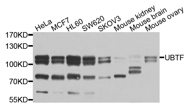 Western blot - UBTF Polyclonal Antibody 
