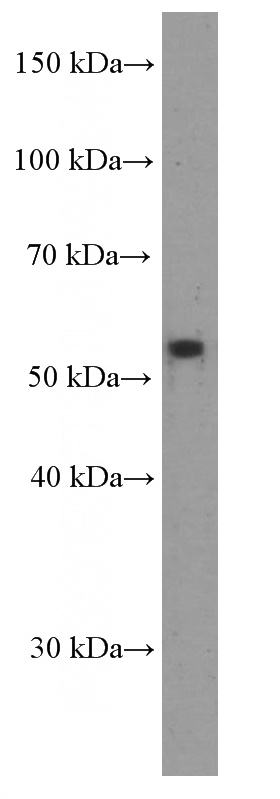 A549 cells were subjected to SDS PAGE followed by western blot with Catalog No:107515(RXRG Antibody) at dilution of 1:2000