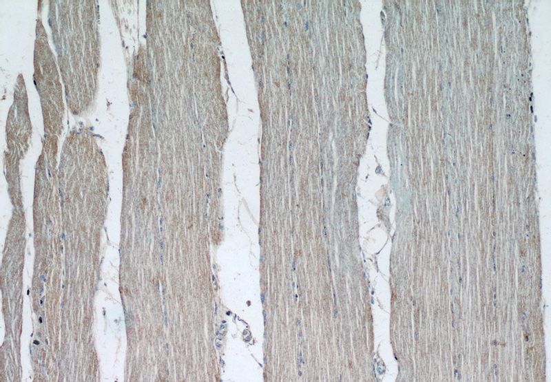 Immunohistochemical of paraffin-embedded human skeletal muscle using Catalog No:112801(MRAS antibody) at dilution of 1:50 (under 10x lens)