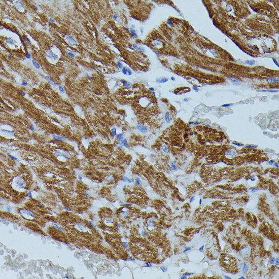Immunohistochemistry - FKBP1B Polyclonal Antibody 
