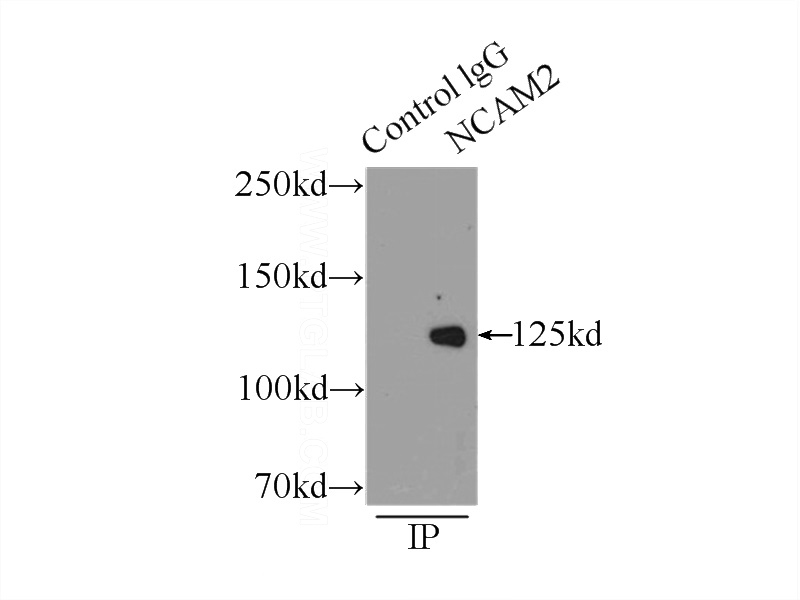 IP Result of anti-NCAM2 (IP:Catalog No:113028, 3ug; Detection:Catalog No:113028 1:1000) with mouse brain tissue lysate 4000ug.