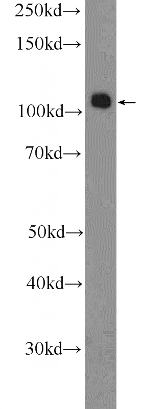 HEK-293 cells were subjected to SDS PAGE followed by western blot with Catalog No:115430(SMARCAL1 Antibody) at dilution of 1:600