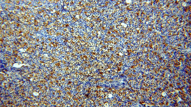 Immunohistochemical of paraffin-embedded human ovary using Catalog No:114032(PNCK antibody) at dilution of 1:50 (under 10x lens)