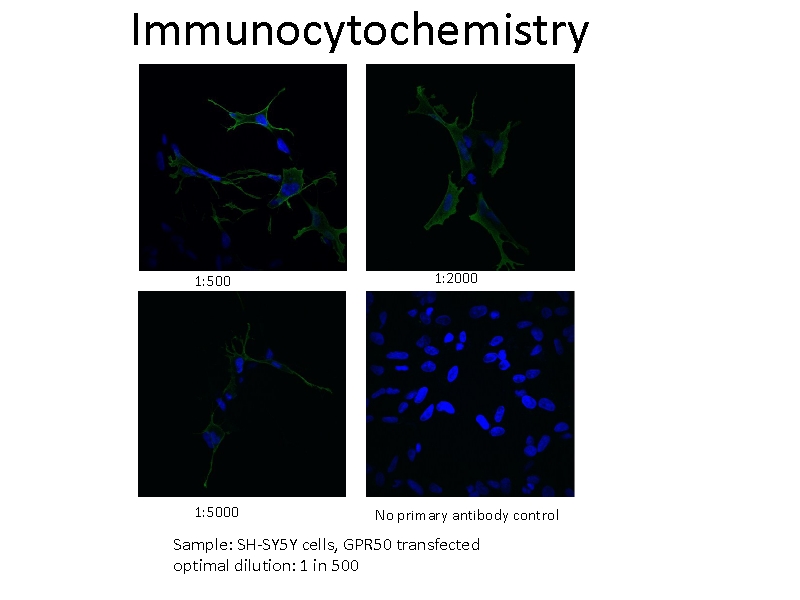 IF result of anti-GPR50 (Catalog No:111130, 1:500) with SH-SY5Y cells transfected with GPR50 by Dr. Qian Li, University of Edinburgh.
