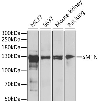 Western blot - SMTN Polyclonal Antibody 