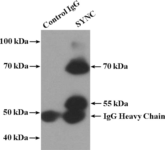 IP Result of anti-SYNC (IP:Catalog No:115779, 4ug; Detection:Catalog No:115779 1:800) with mouse heart tissue lysate 4000ug.