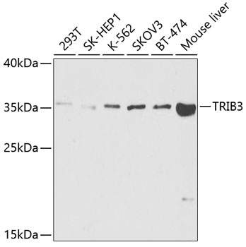 Western blot - TRIB3 Polyclonal Antibody 