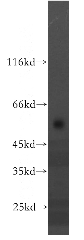 HepG2 cells were subjected to SDS PAGE followed by western blot with Catalog No:116106(TMEM175 antibody) at dilution of 1:500