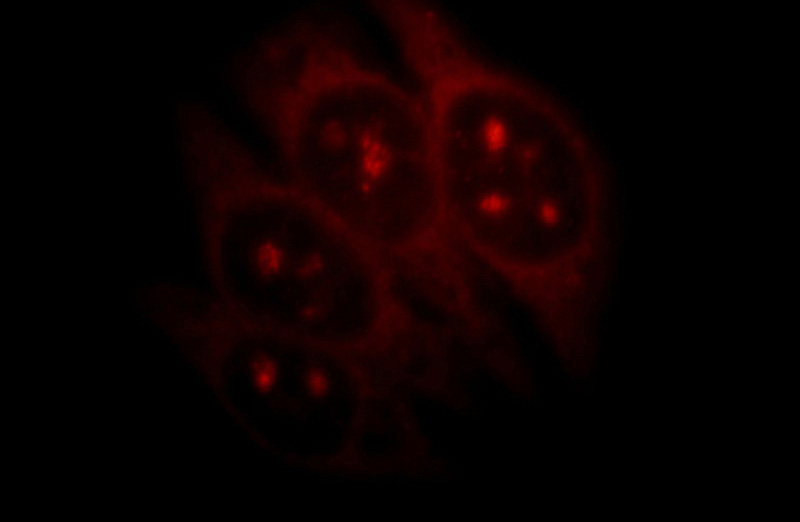 Immunofluorescent analysis of HepG2 cells, using RNF7 antibody Catalog No:114763 at 1:25 dilution and Rhodamine-labeled goat anti-rabbit IgG (red).