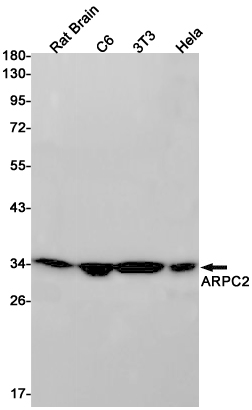 Western blot detection of ARPC2 in Rat Brain,C6,3T3,Hela cell lysates using ARPC2 Rabbit pAb(1:1000 diluted).Predicted band size:34kDa.Observed band size:34kDa.