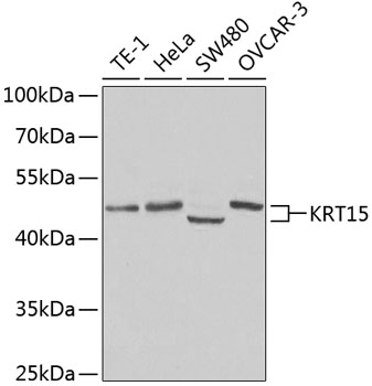 Western blot - KRT15 Polyclonal Antibody 
