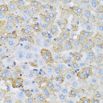 Immunohistochemistry - APOC1 Polyclonal Antibody 
