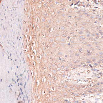 Immunohistochemistry - CDH3 Polyclonal Antibody 