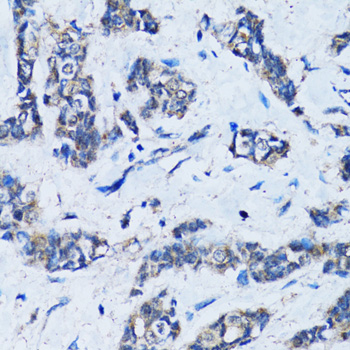 Immunohistochemistry - HDAC5 Polyclonal Antibody 