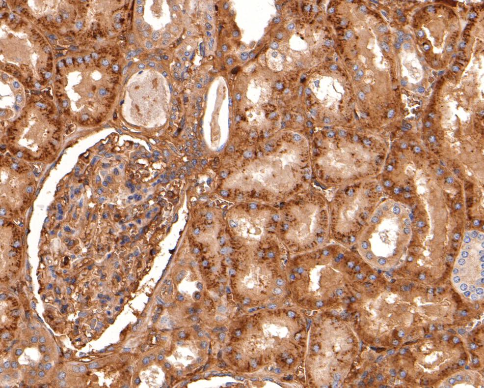 Fig3: Immunohistochemical analysis of paraffin-embedded human kidney tissue using anti-Kininogen 1 antibody. The section was pre-treated using heat mediated antigen retrieval with Tris-EDTA buffer (pH 8.0-8.4) for 20 minutes. The tissues were blocked in 5% BSA for 30 minutes at room temperature, washed with ddH2O and PBS, and then probed with the antibody at 1/100 dilution, for 30 minutes at room temperature and detected using an HRP conjugated compact polymer system. DAB was used as the chrogen. Counter stained with hematoxylin and mounted with DPX.