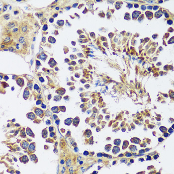 Immunohistochemistry - CCDC124 Polyclonal Antibody 