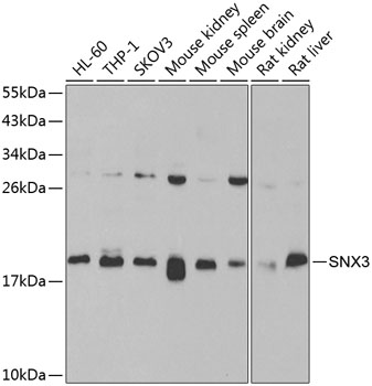 Western blot - SNX3 Polyclonal Antibody 