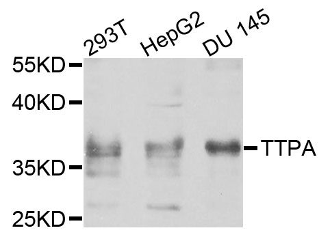 Western blot - TTPA Polyclonal Antibody 