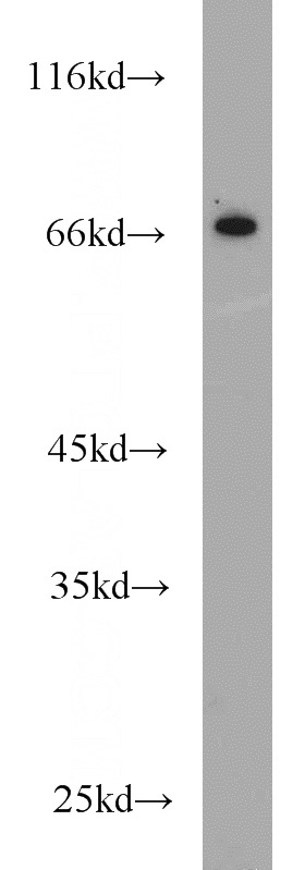 mouse testis tissue were subjected to SDS PAGE followed by western blot with Catalog No:114642(RGS14 antibody) at dilution of 1:500