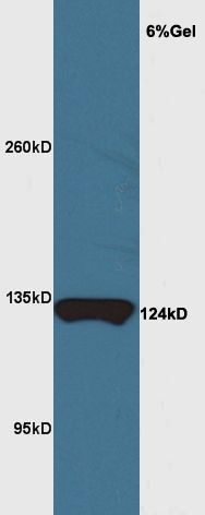 Fig2: Sample: Brain (Mouse) Lysate at 40 ug; Primary: Anti-MRF/C11orf9 at 1/300 dilution; Secondary: HRP conjugated Goat-Anti-rabbit IgG (bs-0295G-HRP) at 1/5000 dilution; Predicted band size: 124 kD; Observed band size: 124 kD