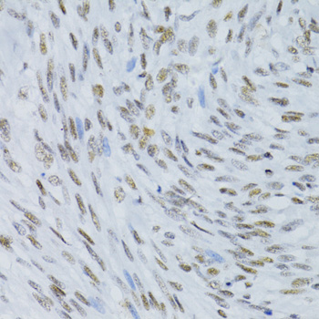 Immunohistochemistry - SNRNP70 Polyclonal Antibody 