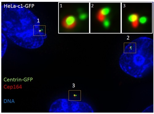 IF results of CEP164 (Catalog No:109267, 1:1000) with HeLa cells (1.5% formaldehyde, 10 min RT) by Laboratory of Protein Dynamics and Signaling; Center for Cancer Research, National Cancer Institute.