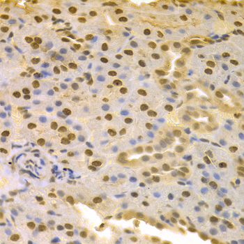 Immunohistochemistry - COPS5 Polyclonal Antibody 