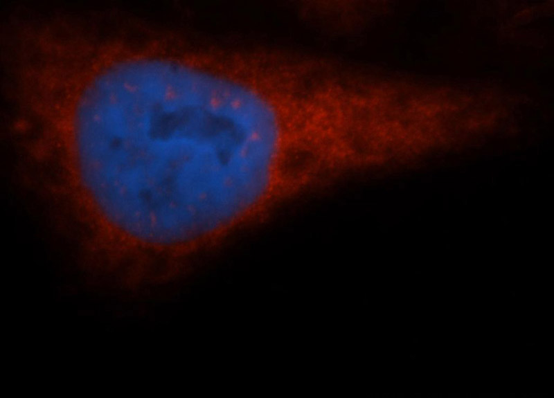 Immunofluorescent analysis of HepG2 cells, using EIF2S1 antibody Catalog No:110187 at 1:50 dilution and Rhodamine-labeled goat anti-rabbit IgG (red). Blue pseudocolor = DAPI (fluorescent DNA dye).