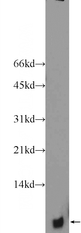 mouse brain tissue were subjected to SDS PAGE followed by western blot with Catalog No:113750(PCP4L1 Antibody) at dilution of 1:600