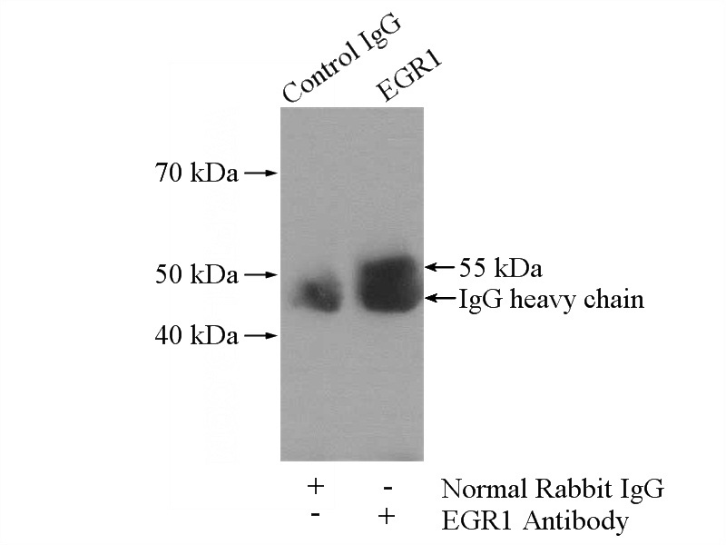 IP Result of anti-EGR1 (IP:Catalog No:110220, 4ug; Detection:Catalog No:110220 1:500) with mouse brain tissue lysate 2640ug.