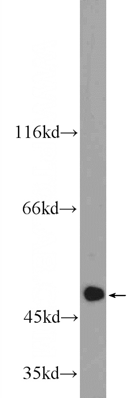 MCF-7 cells were subjected to SDS PAGE followed by western blot with Catalog No:108784(C6orf211 Antibody) at dilution of 1:600