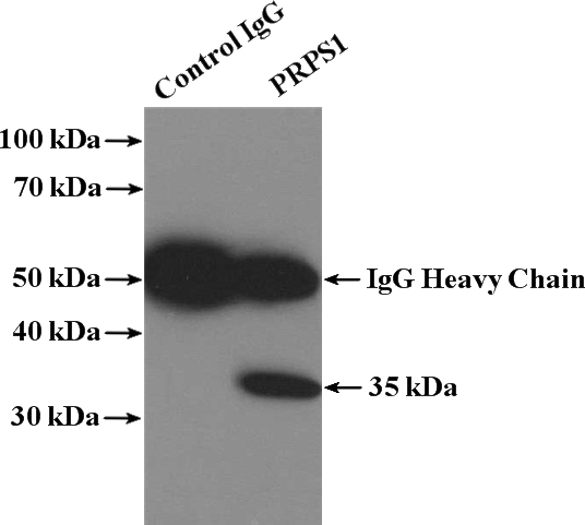 IP Result of anti-PRPS1 (IP:Catalog No:114237, 4ug; Detection:Catalog No:114237 1:100) with HeLa cells lysate 2600ug.