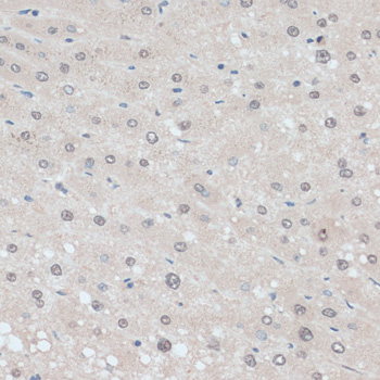 Immunohistochemistry - ZNF707 Polyclonal Antibody 