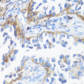 Immunohistochemistry - HLA-DRB3 Polyclonal Antibody 