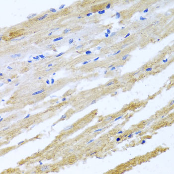 Immunohistochemistry - BNIP3 Polyclonal Antibody 