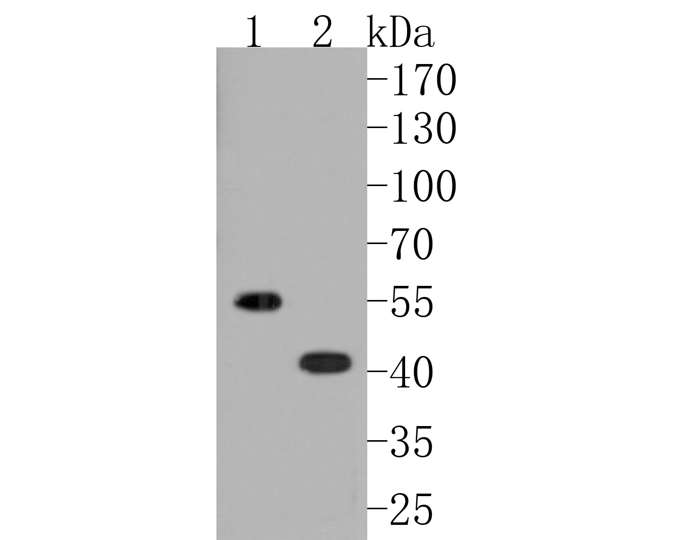 Fig1:; Western blot analysis of Oxytocin Receptor on different lysates. Proteins were transferred to a PVDF membrane and blocked with 5% BSA in PBS for 1 hour at room temperature. The primary antibody ( 1/500) was used in 5% BSA at room temperature for 2 hours. Goat Anti-Rabbit IgG - HRP Secondary Antibody (HA1001) at 1:5,000 dilution was used for 1 hour at room temperature.; Positive control:; Lane 1: Mouse uterus tissue lysate; Lane 2: Jurkat cell lysate
