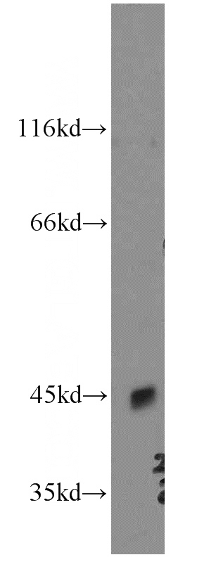 HeLa cells were subjected to SDS PAGE followed by western blot with Catalog No:113413(OPRL1 antibody) at dilution of 1:500