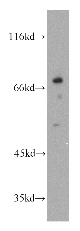 mouse kidney tissue were subjected to SDS PAGE followed by western blot with Catalog No:116766(VNN1 antibody) at dilution of 1:300