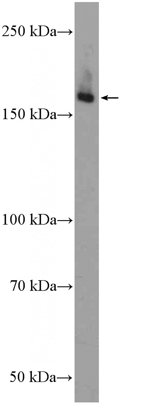 rat skeletal muscle tissue were subjected to SDS PAGE followed by western blot with Catalog No:116568(ULK1 Antibody) at dilution of 1:300