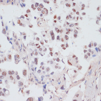 Immunohistochemistry - Phospho-PEA15-S104 pAb 